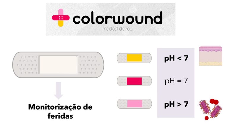 IPG procura parceiro industrial para produzir “penso inteligente”