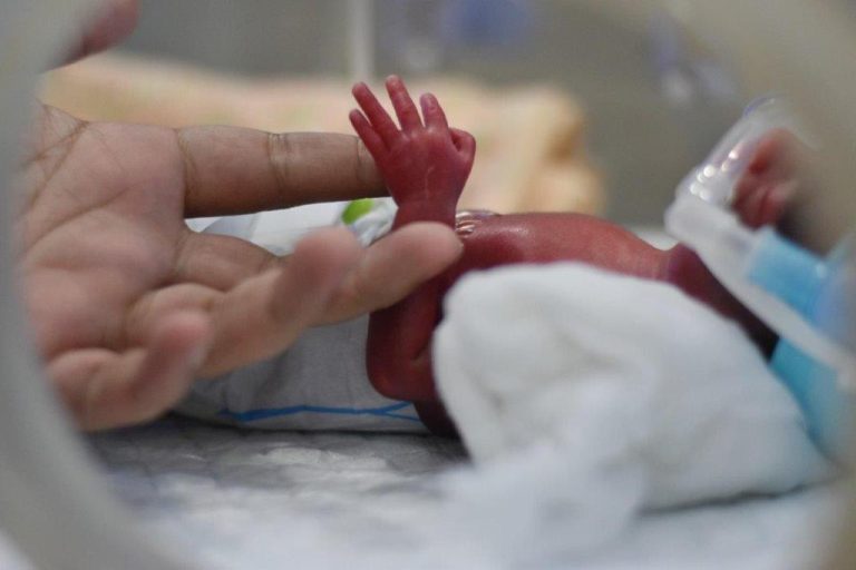 ULSGuarda assinala Dia Mundial da Prematuridade
